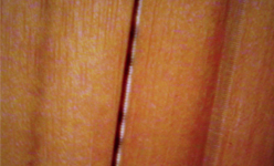 stringness-button-osira-verspyck